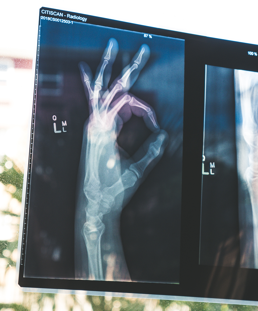 Medical X-ray scan interface